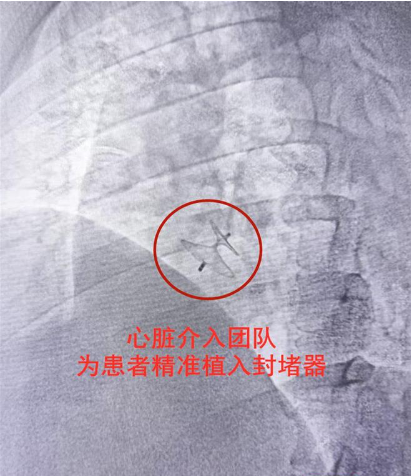 男子十余年头痛难止，原是心“破”了