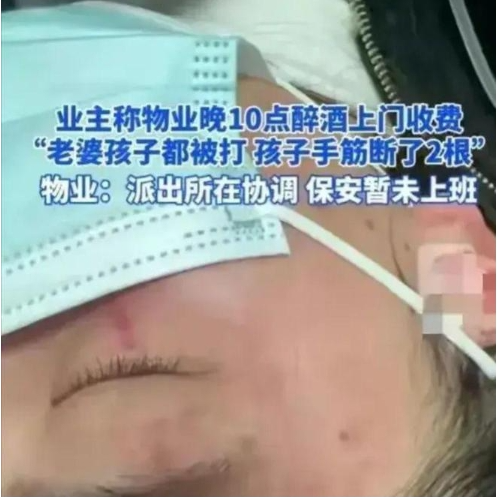 物业醉酒上门，业主女儿手筋被断后续：业主涉故意伤害，取保一年